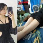 Da trắng lộ hàng